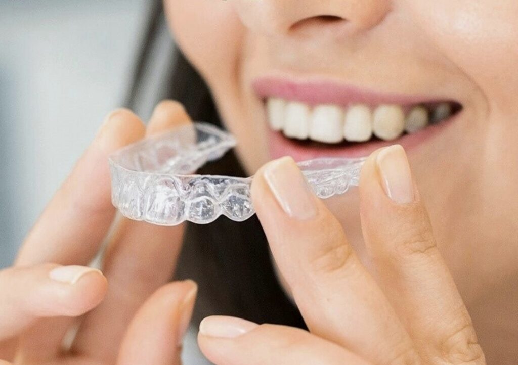 A Woman with custom made Clear Aligner Tray