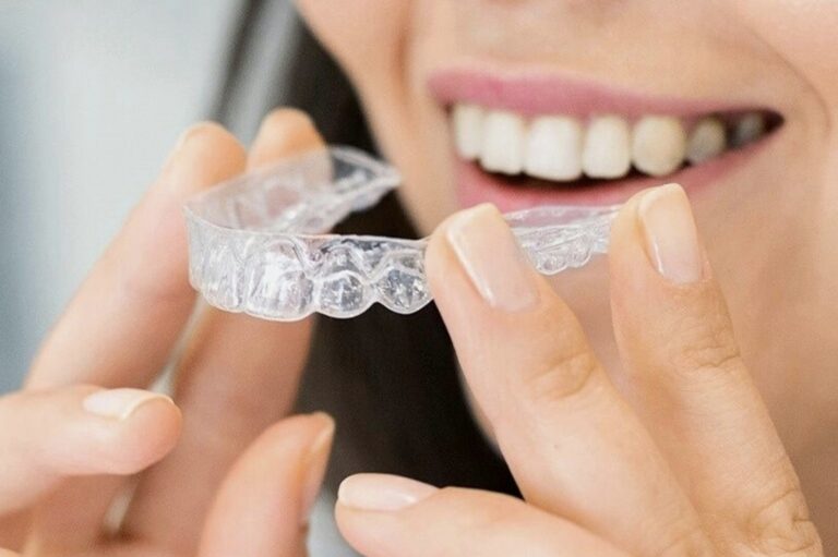 A woman with custom made clear aligner tray
