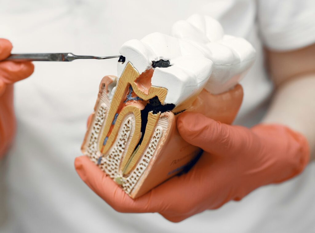 Image showing Root Canal Anatomy of a Tooth